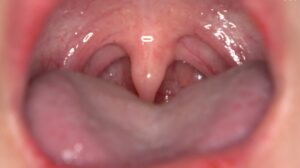 「【歯・口腔フェチ】新人女優相楽さゆなちゃんの口内観察&巨大女フェチ」わかしラボWAKA-078 相楽さゆな 9