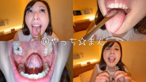 【個人撮影】横山夏希の舌ブラシで「汚舌苔」採取